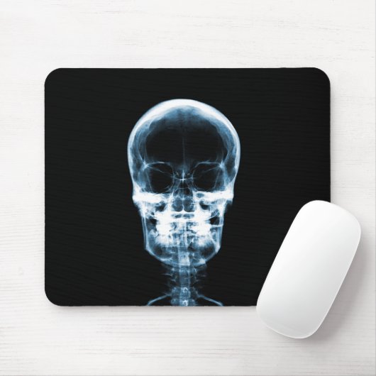 RÖNTGENBLICK-SKELETON SCHÄDEL - BLAU MOUSEPAD (Mit Mouse)