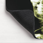 RÖNTGENBLICK-SKELETON SCHÄDEL - GELB MOUSEPAD (Ecke)