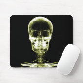 RÖNTGENBLICK-SKELETON SCHÄDEL - GELB MOUSEPAD (Mit Mouse)