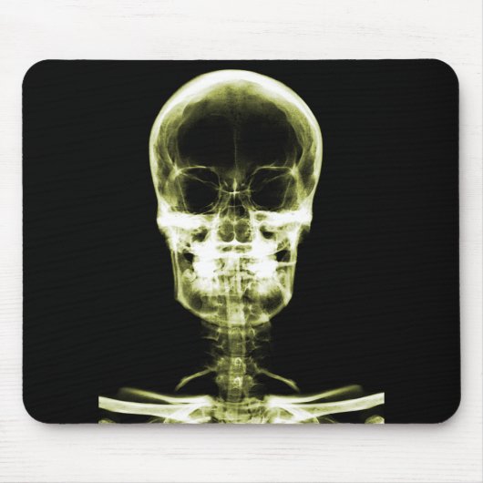 RÖNTGENBLICK-SKELETON SCHÄDEL - GELB MOUSEPAD (Vorne)