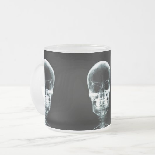 RÖNTGENBLICK-SKELETON SCHÄDEL - VORLAGE MATTGLASTASSE (Vorderseite Links)