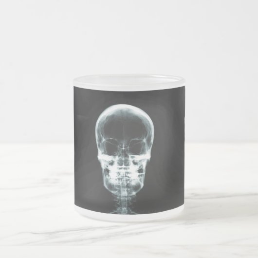 RÖNTGENBLICK-SKELETON SCHÄDEL - VORLAGE MATTGLASTASSE (Mittel)