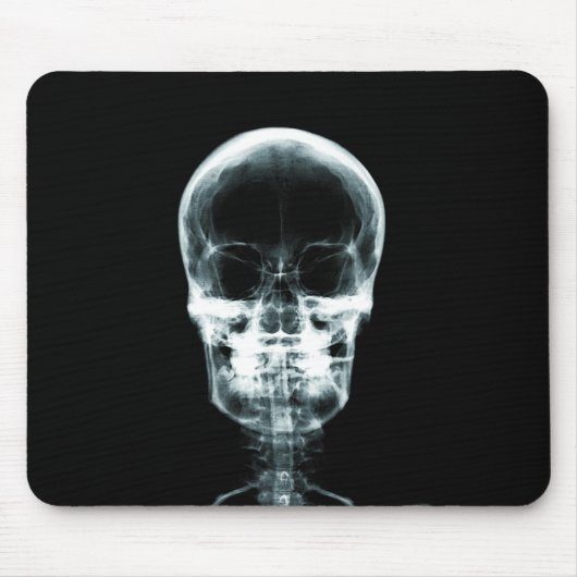 RÖNTGENBLICK-SKELETON SCHÄDEL - VORLAGE MOUSEPAD (Vorne)