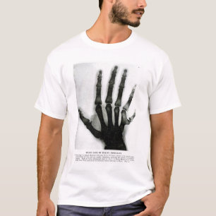Röntgenhand mit Extra-Finger-Shirt T-Shirt