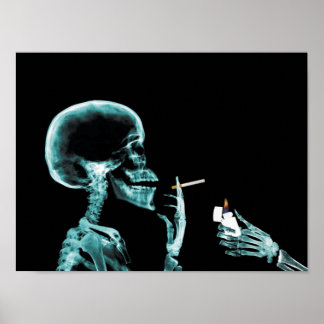 Röntgenposter Poster