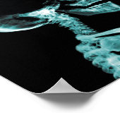 Röntgenposter Poster (Ecke)