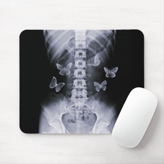 Röntgenstrahl-Begriffsschmetterlinge Mousepad (Mit Mouse)