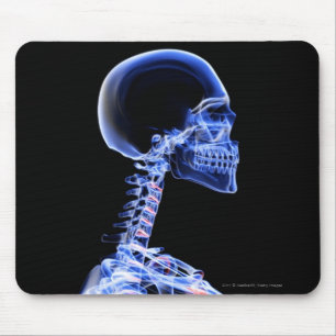 Röntgenstrahl der Knochen im Hals Mousepad