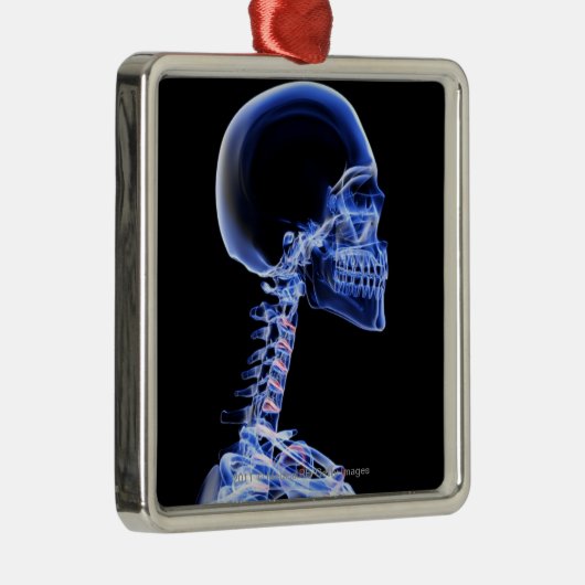 Röntgenstrahl der Knochen im Hals Ornament Aus Metall (Rechts)