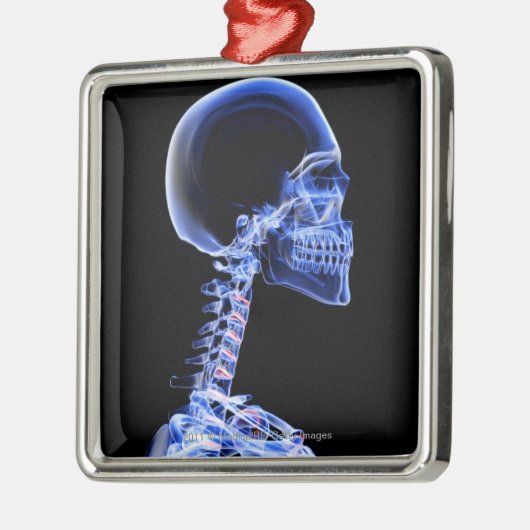 Röntgenstrahl der Knochen im Hals Ornament Aus Metall (Links)