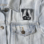 Röntgenstrahl der Schmetterlinge im Magen Button (Beispiel)