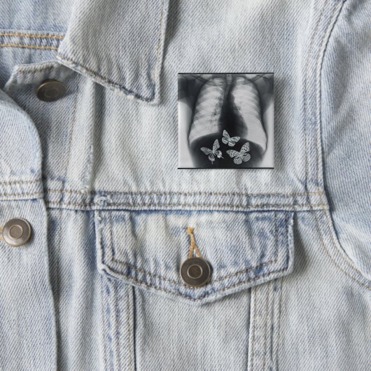 Röntgenstrahl der Schmetterlinge im Magen Button (Beispiel)