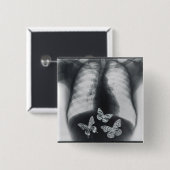 Röntgenstrahl der Schmetterlinge im Magen Button (Vorne & Hinten)