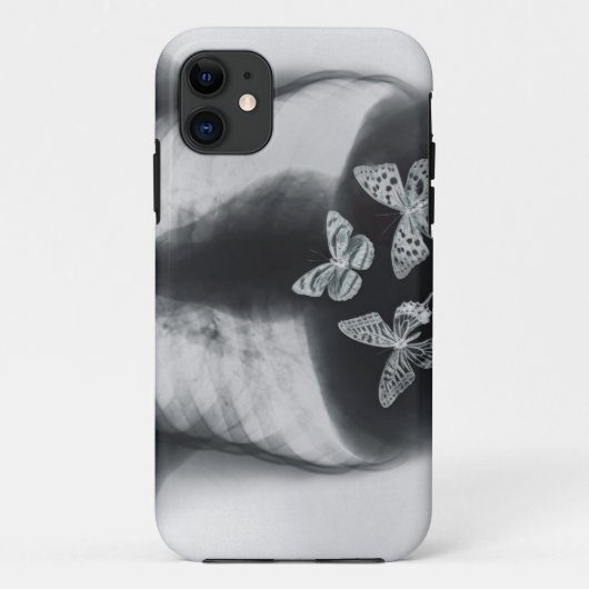 Röntgenstrahl der Schmetterlinge im Magen Case-Mate iPhone Hülle (Rückseite)