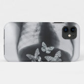 Röntgenstrahl der Schmetterlinge im Magen Case-Mate iPhone Hülle (Rückseite (Horizontal))