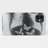 Röntgenstrahl der Schmetterlinge im Magen Case-Mate iPhone Hülle (Rückseite (Horizontal))