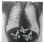 Röntgenstrahl der Schmetterlinge im Magen Fliese (Vorderseite)