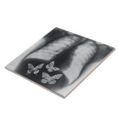 Röntgenstrahl der Schmetterlinge im Magen Fliese (Seite)