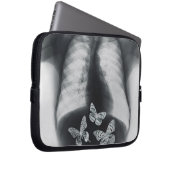 Röntgenstrahl der Schmetterlinge im Magen Laptopschutzhülle (Vorne Rechts)