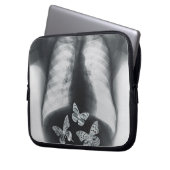 Röntgenstrahl der Schmetterlinge im Magen Laptopschutzhülle (Vorderseite Links)