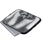 Röntgenstrahl der Schmetterlinge im Magen Laptopschutzhülle (Vorne Knopf)