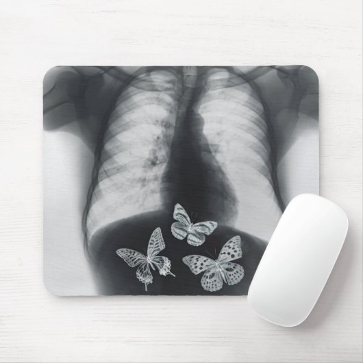 Röntgenstrahl der Schmetterlinge im Magen Mousepad (Mit Mouse)