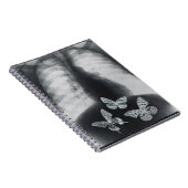 Röntgenstrahl der Schmetterlinge im Magen Notizblock (Rechte Seite)