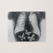 Röntgenstrahl der Schmetterlinge im Magen Puzzle (Horizontal)