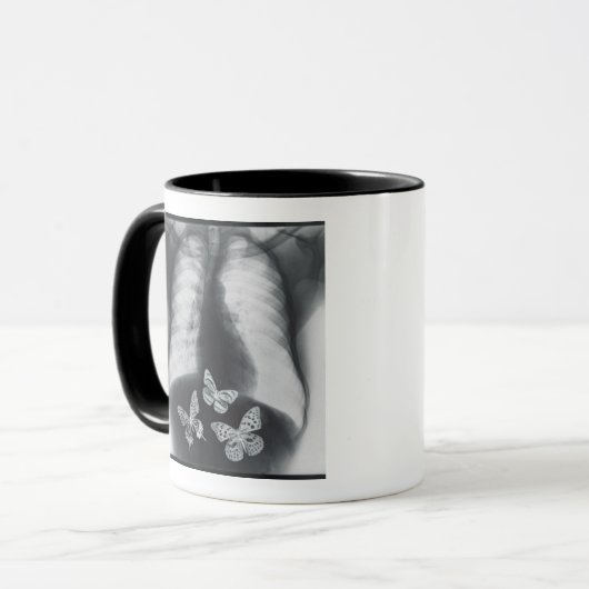 Röntgenstrahl der Schmetterlinge im Magen Tasse (Vorderseite Links)