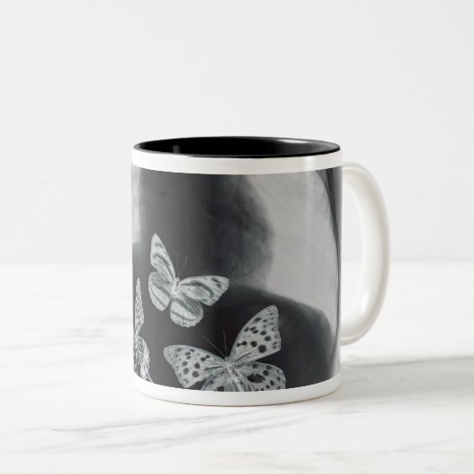 Röntgenstrahl der Schmetterlinge im Magen Zweifarbige Tasse (VorderseiteRechts)
