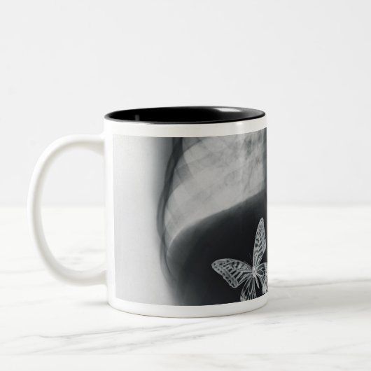 Röntgenstrahl der Schmetterlinge im Magen Zweifarbige Tasse (Links)