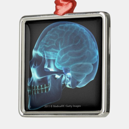 Röntgenstrahl des Gehirns innerhalb eines Schädels Silbernes Ornament (Links)