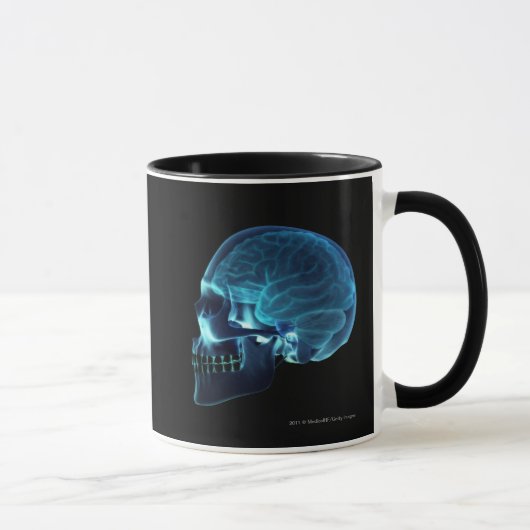 Röntgenstrahl des Gehirns innerhalb eines Schädels Tasse (Rechts)