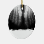 Röntgenstrahl-Fuß-menschliches Skeleton Keramik Ornament (Rechts)