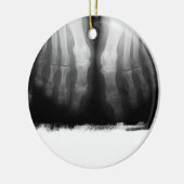 Röntgenstrahl-Fuß-menschliches Skeleton Keramik Ornament (Links)