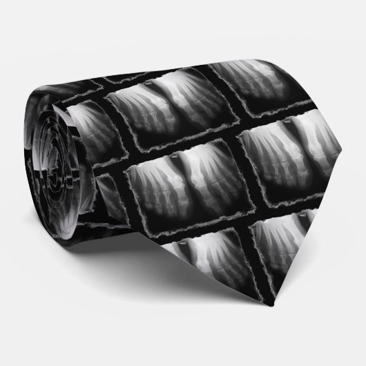 Röntgenstrahl-Fuß-menschliches Skeleton Krawatte (Gerollt)