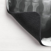 Röntgenstrahl-Fuß-menschliches Skeleton Mousepad (Ecke)