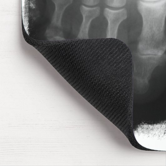 Röntgenstrahl-Fuß-menschliches Skeleton Mousepad (Ecke)