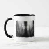 Röntgenstrahl-Fuß-menschliches Skeleton Tasse (Links)