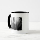 Röntgenstrahl-Fuß-menschliches Skeleton Tasse (Vorderseite Links)