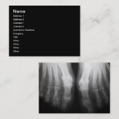Röntgenstrahl-Fuß-menschliches Skeleton Visitenkarte (Vorne/Hinten)