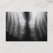 Röntgenstrahl-Fuß-menschliches Skeleton Visitenkarte (Rückseite)