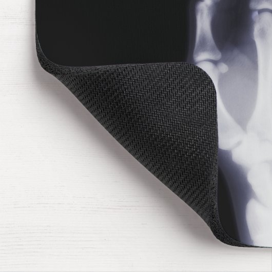 Röntgenstrahl-Hand Mousepad (Ecke)