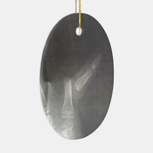 Röntgenstrahl Keramik Ornament (Rechts)