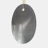 Röntgenstrahl Keramik Ornament (Links)