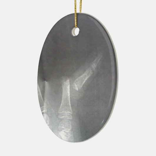 Röntgenstrahl Keramik Ornament (Links)