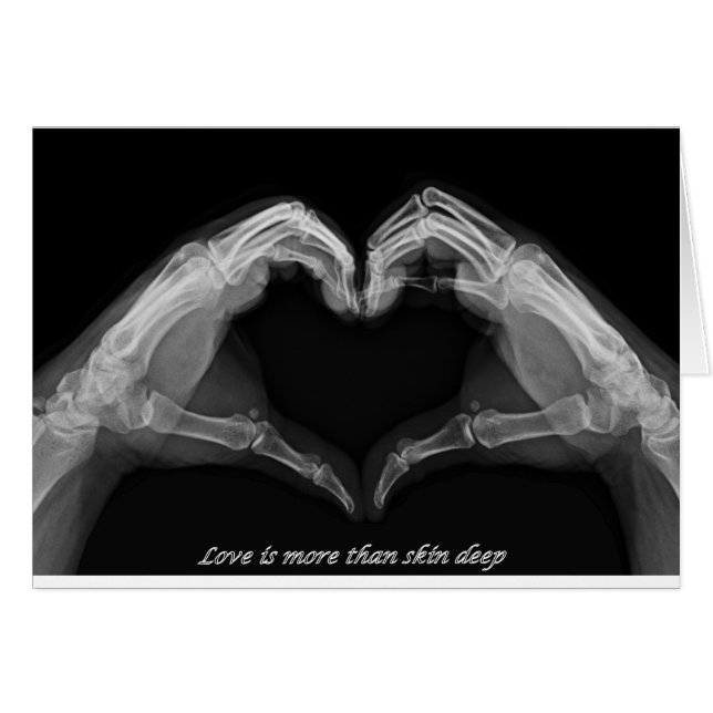 Röntgenstrahl-Kunst (Vorderseite (Horizontal))