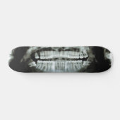Röntgenstrahl Skateboard (Horizontal)