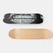 Röntgenstrahl Skateboard (Horizontal)
