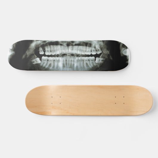 Röntgenstrahl Skateboard (Horizontal)